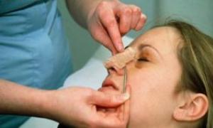 Chirurgie du nez : comment travailler et à quel point c'est difficile ?