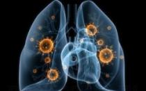 Chi rodo fluorografinį bronchitą
